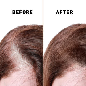 Anti Hair Loss Serum 2 In 1 Natural Hair Fall Serum Ginger And Tocopherol Hair Growth Essence Oil Hair Care Serum | Hair Loss Treatment For Men & Women |