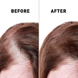 Anti Hair Loss Serum 2 In 1 Natural Hair Fall Serum Ginger And Tocopherol Hair Growth Essence Oil Hair Care Serum | Hair Loss Treatment For Men & Women |
