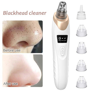 Upgraded blackhead remover vacuum facial pore cleaner electric acne comedone whitehead extractor tool 5 probes for women and men ardrop27068561