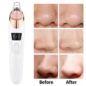 Upgraded blackhead remover vacuum facial pore cleaner electric acne comedone whitehead extractor tool 5 probes for women and men ardrop27068561
