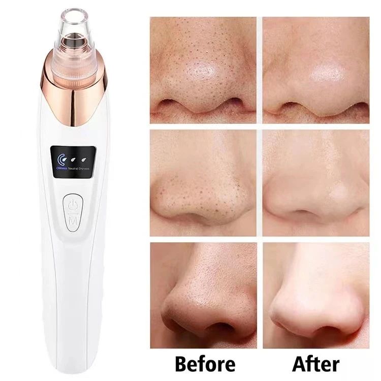 Upgraded blackhead remover vacuum facial pore cleaner electric acne comedone whitehead extractor tool 5 probes for women and men ardrop27068561