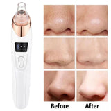 Upgraded blackhead remover vacuum facial pore cleaner electric acne comedone whitehead extractor tool 5 probes for women and men ardrop27068561